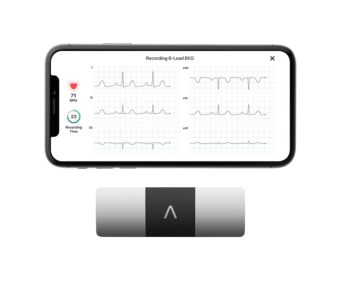 KardiaMobile 6-Lead Personal EKG Monitor – Six Views of The Heart – Detects AFib and Irregular Arrhythmias – Instant Results in 30 Seconds – Works with Most Smartphones -...