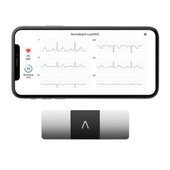 KardiaMobile 6-Lead Personal EKG Monitor – Six Views of The Heart – Detects AFib and Irregular Arrhythmias – Instant Results in 30 Seconds – Works with Most Smartphones -...